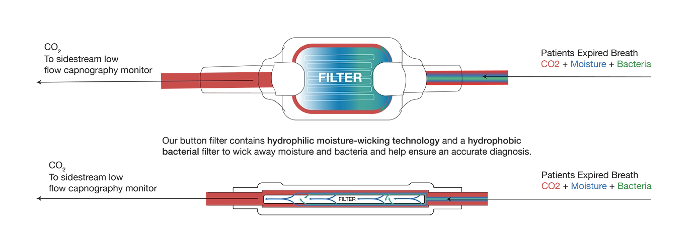 Button Filter Diagram